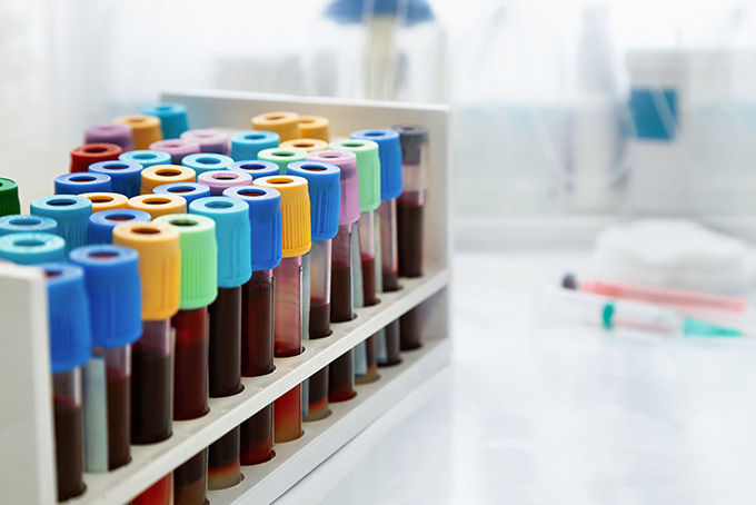 Lab vials in a laboratory 